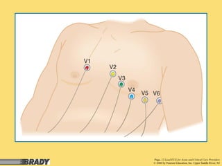 ekg lead placement and aquisition of 12 lead electrocardiogram.pdf