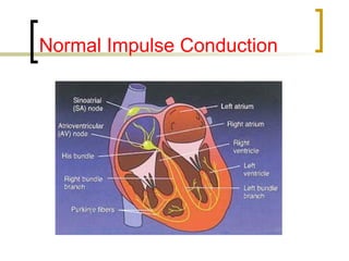 Electrocardiography for physiotehrapists | PPT