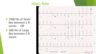 Comprehensive Guide to ECG Analysis: From Waves to Diagnosis | PPTX