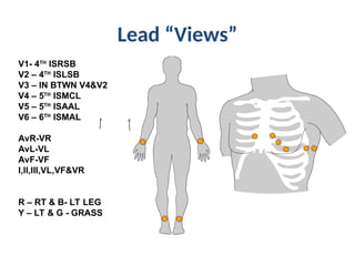 Comprehensive Guide to Electrocardiogram (ECG) Interpretation and ...