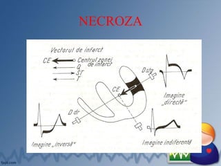 NECROZA
 