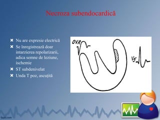 Necroza subendocardică
 Nu are expresie electrică
 Se înregistrează doar
intarzierea repolarizarii,
adica semne de leziune,
ischemie
 ST subdenivelat
 Unda T poz, ascuțită
 
