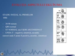 EVOLUŢIA ASPECTULUI EKG ÎN IMA
STADIU INIȚIAL AL PRIMELOR
ORE
- 30-90 minute
- QRS normal
- ST NORMAL sau UȘOR ASCENSIONAT
- UNDA T – negativă, simetrică, ascuțită;
(rareori unda T poate fi pozitiva, ascutita , simetrica)
28
 