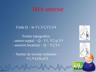 IMA anterior
Unda Q – în V1,V2,V3,V4
Forme topografice
- antero-septal – Q - V1, V2 și V3
- anterior localizat – Q – V2,V3
- Semne de leziune ischemie –
V1,V4,DI,aVL
 
