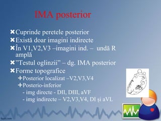 IMA posterior
Cuprinde peretele posterior
Există doar imagini indirecte
În V1,V2,V3 –imagini ind. – undă R
amplă
”Testul oglinzii” – dg. IMA posterior
Forme topografice
Posterior localizat –V2,V3,V4
Posterio-inferior
- img directe - DII, DIII, aVF
- img indirecte – V2,V3,V4, DI și aVL
 