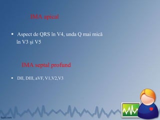 IMA apical
 Aspect de QRS în V4, unda Q mai mică
în V3 și V5
IMA septal profund
 DII, DIII, aVF, V1,V2,V3
 