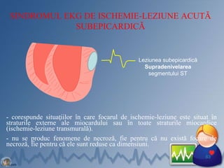 SINDROMUL EKG DE ISCHEMIE-LEZIUNE ACUTĂ
SUBEPICARDICĂ
- corespunde situaţiilor în care focarul de ischemie-leziune este situat în
straturile externe ale miocardului sau în toate straturile miocardice
(ischemie-leziune transmurală).
- nu se produc fenomene de necroză, fie pentru că nu există focare de
necroză, fie pentru că ele sunt reduse ca dimensiuni.
63
Leziunea subepicardică
Supradenivelarea
segmentului ST
 