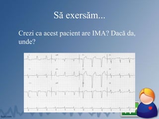 Să exersăm...
Crezi ca acest pacient are IMA? Dacă da,
unde?
 