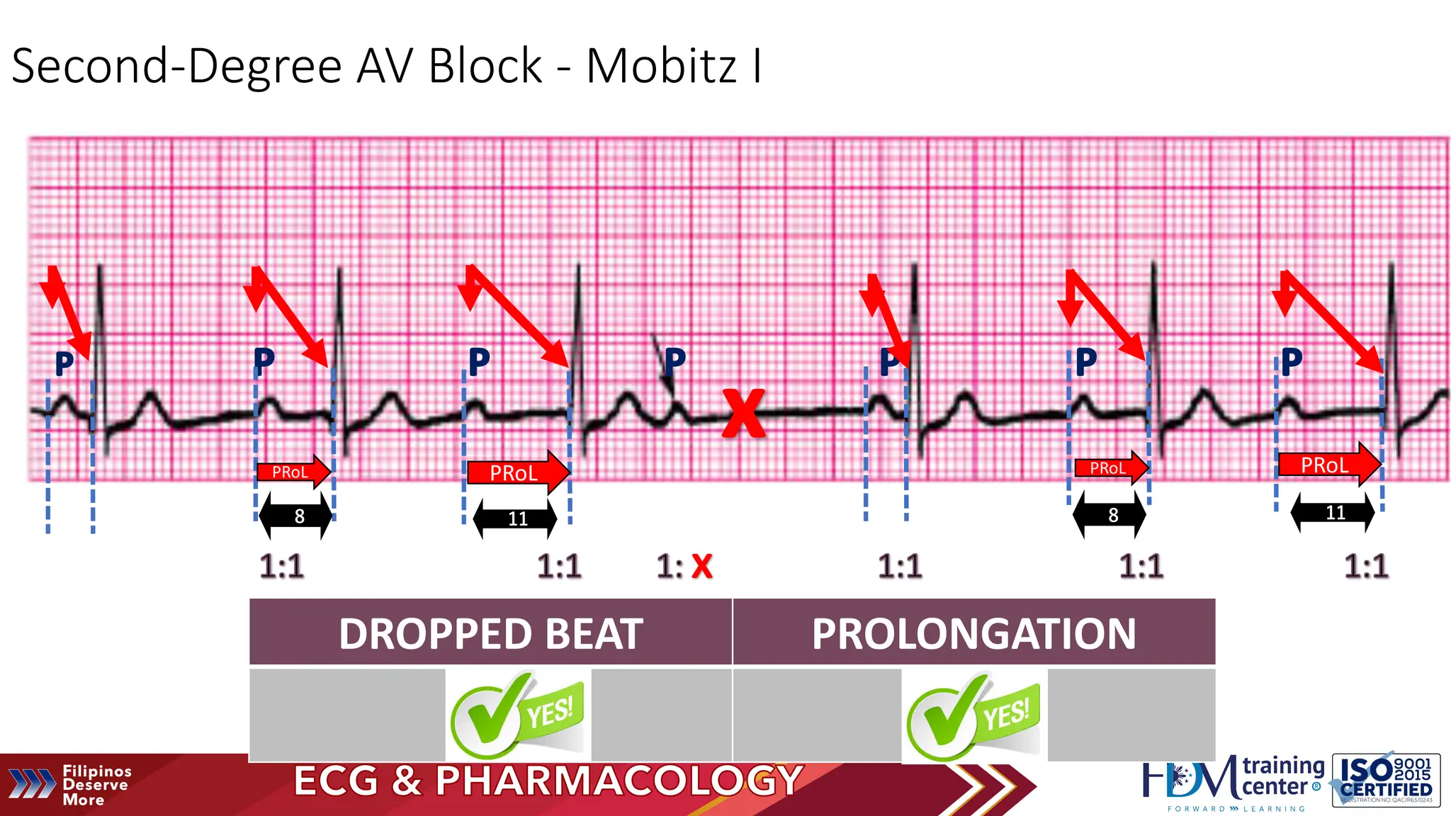 electrocardiogram and pharmacology- acls 2020 module | PDF