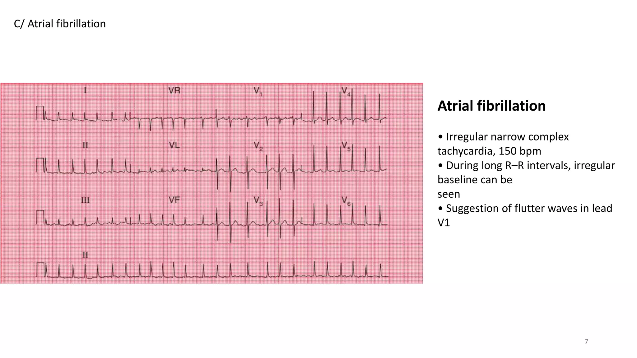 ECG-cases.pptx