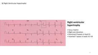ECG-cases.pptx