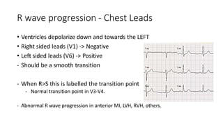 ECG | PPTX