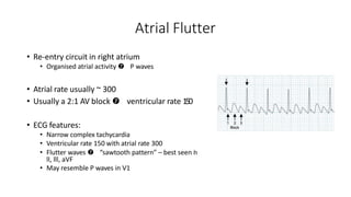ECG | PPTX