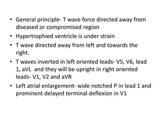 • General principle- T wave force directed away from
diseased or compromised region
• Hypertrophied ventricle is under strain
• T wave directed away from left and towards the
right.
• T waves inverted in left oriented leads- V5, V6, lead
1, aVL and they will be upright in right oriented
leads- V1, V2 and aVR
• Left atrial enlargement- wide notched P in lead 1 and
prominent delayed terminal deflexion in V1
 