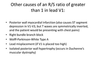 Other causes of an R/S ratio of greater
than 1 in lead V1:
• Posterior wall myocardial infarction (also causes ST segment
depression in V1-V3, but T waves are symmetrically inverted,
and the patient would be presenting with chest pains)
• Right bundle branch block
• Wolff-Parkinson-White Type A
• Lead misplacement (if V1 is placed too high)
• Isolated posterior wall hypertrophy (occurs in Duchenne’s
muscular dystrophy)
 