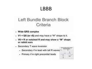 LBBB
 