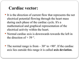 Vector Examples Ecg ECG - Electrocardiogram_d9d2329b-d1ce-4fea-b935-36c814f0a86d.pptx
