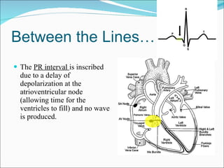 Between the Lines… The  PR interval  is inscribed due to a delay of depolarization at the atrioventricular node (allowing time for the ventricles to fill) and no wave is produced.  