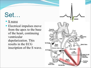 Set… S wave Electrical impulses move from the apex to the base of the heart, continuing ventricular depolarization. This results in the ECG inscription of the S wave. 