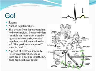 Go! T wave Ahhhh! Repolarization. This occurs from the endocardium to the epicardium. Because the left ventricle has more mass than the right ventricle or atria, electrical impulses travel downward to the left. This produces an upward T wave in Lead II. A period of electrical inactivity follows repolarization, and is inscribed as a flat line until the SA node begins all over again! 