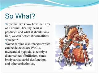 So What? Now that we know how the ECG of a normal, healthy heart is produced and what it should look like, we can detect abnormalities. Excited? Some cardiac disturbances which can be detected are PVC’s, myocardial hypoxia, electrolyte disturbances, fibrillation, sinus bradycardia, atrial dysfunction, and other arrhythmias. 