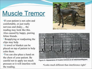 Muscle Tremor If your patient is not calm and comfortable, or just really nervous and shaky… the reading may look like this.  Also caused by happy, purring feline friends. Reapplying or readjusting the clips may help.  A towel or blanket can be placed on top of patient to help calm them. You can also place a hand on the chest of your patient. Be careful not to apply too much pressure or it will interfere with the reading.  Looks much different than interference right? 