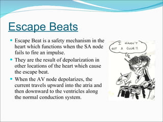 Escape Beats Escape Beat is a safety mechanism in the heart which functions when the SA node fails to fire an impulse. They are the result of depolarization in other locations of the heart which cause the escape beat.  When the AV node depolarizes, the current travels upward into the atria and then downward to the ventricles along the normal conduction system. 