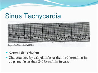 Sinus Tachycardia Normal sinus rhythm. Characterized by a rhythm faster then 160 beats/min in dogs and faster than 240 beats/min in cats. 