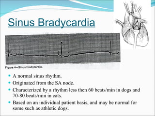 Sinus Bradycardia A normal sinus rhythm. Originated from the SA node. Characterized by a rhythm less then 60 beats/min in dogs and 70-80 beats/min in cats. Based on an individual patient basis, and may be normal for some such as athletic dogs.  