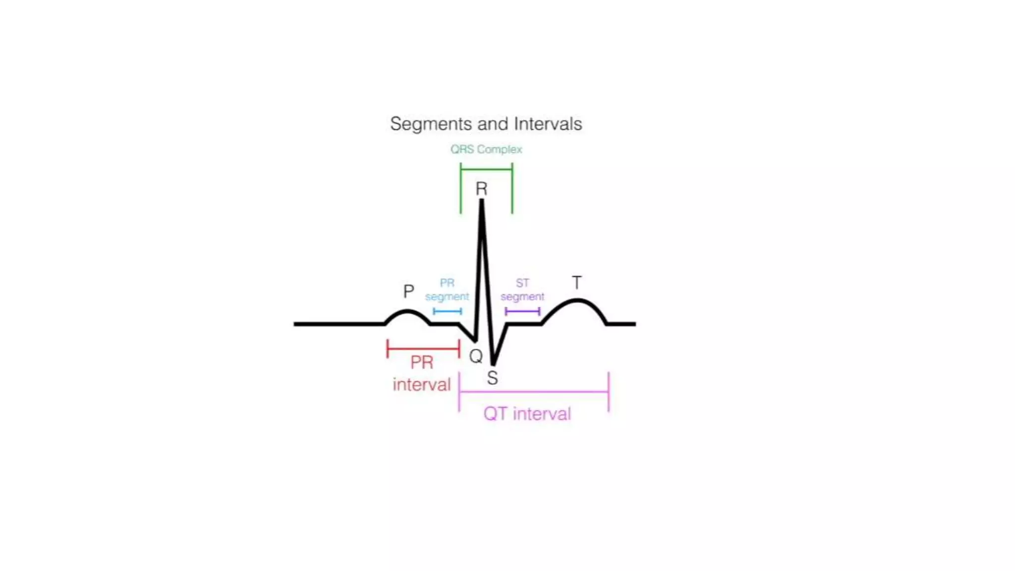 ECG-Interpretation-1.pptx