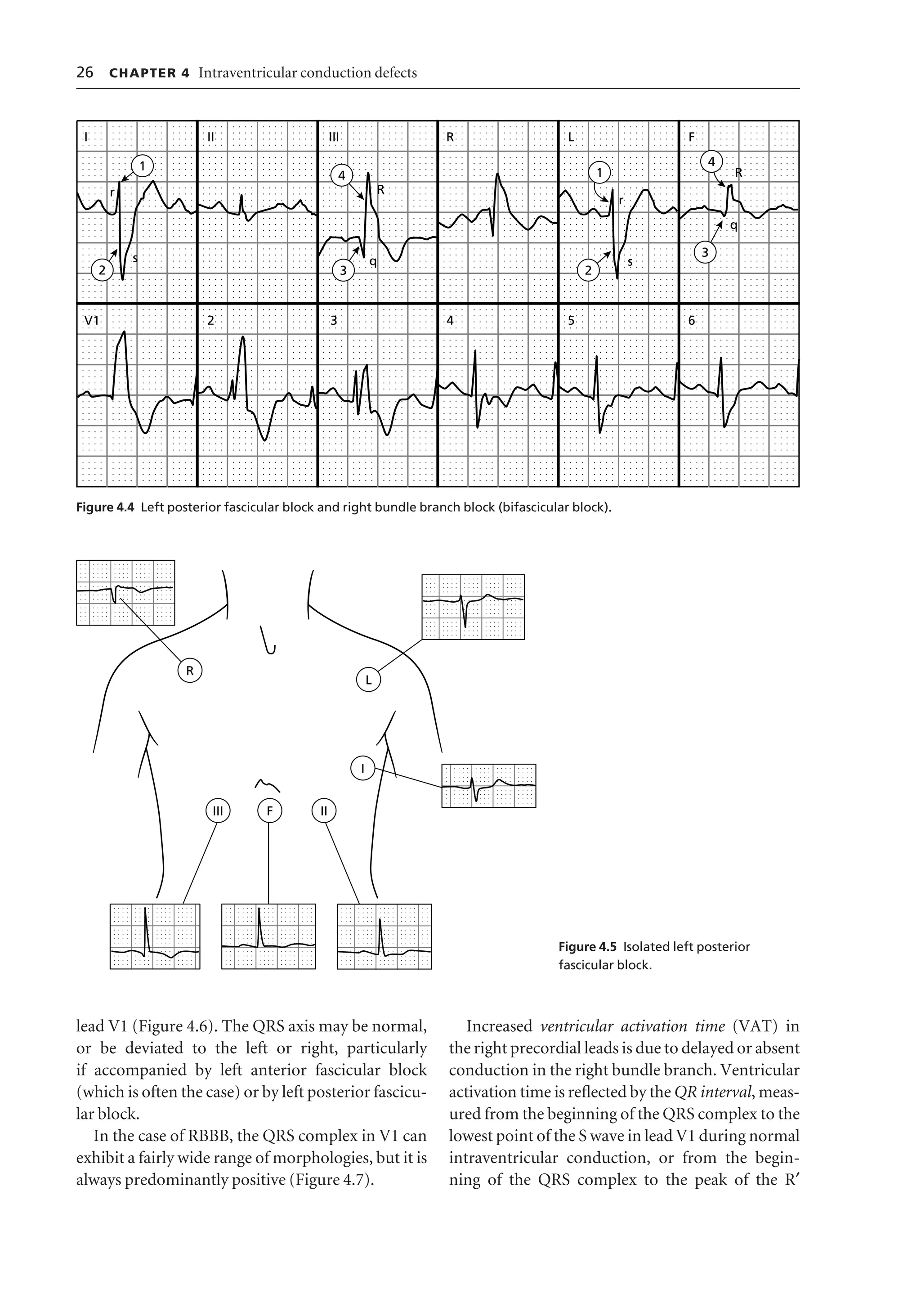 Ecg interpretation | PDF | Heart and Cardiovascular Diseases | Diseases ...
