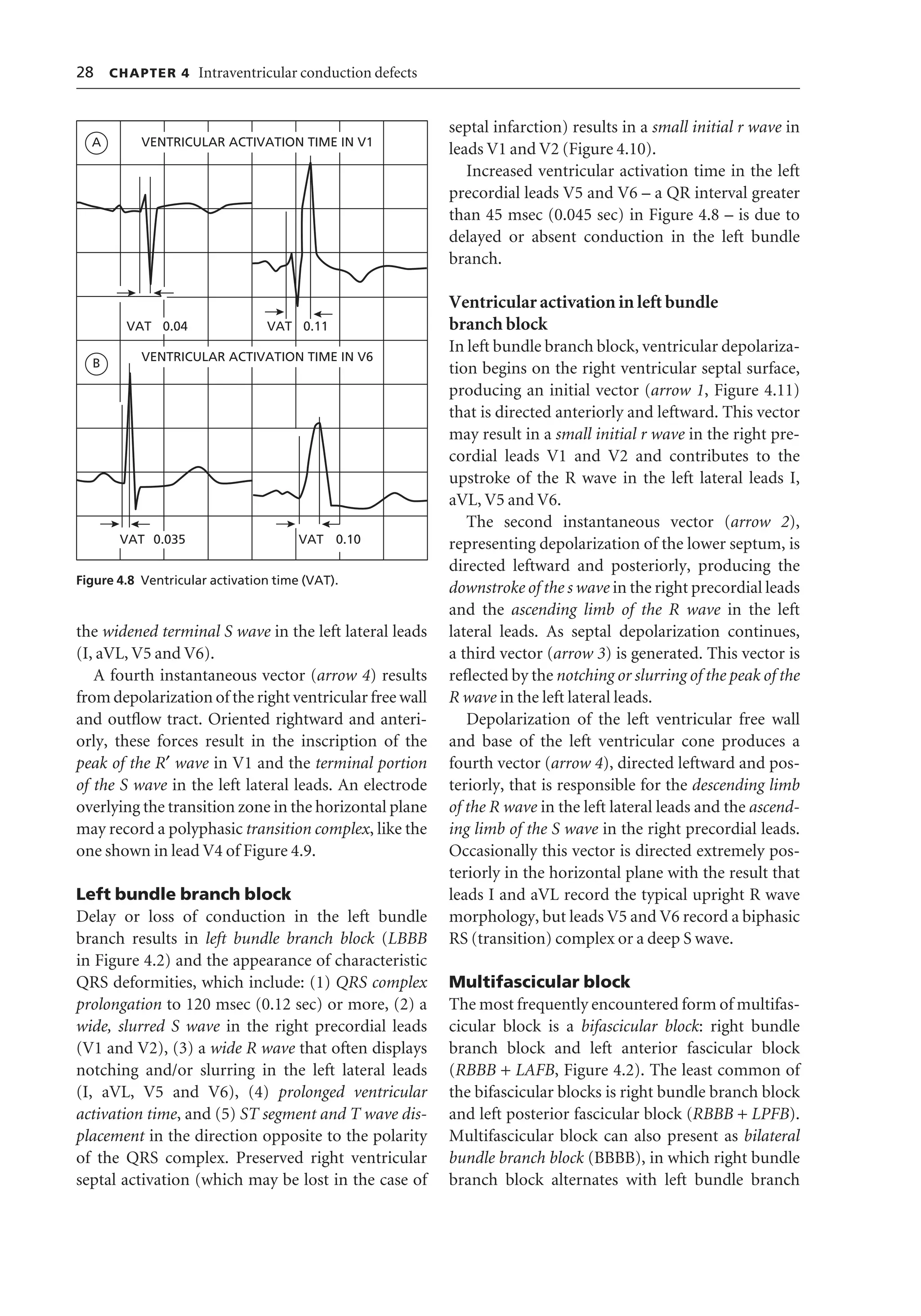 Ecg interpretation | PDF | Heart and Cardiovascular Diseases | Diseases ...