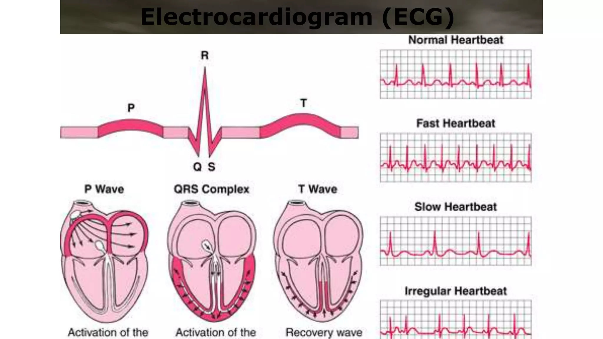 ECG-Interpretation-ppt-for-student.pptx