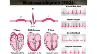 ECG-Interpretation-ppt-for-student.pptx | Heart and Cardiovascular ...