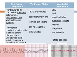 Ventricular
Tachycardia
-ventricular QRS
complexes are highly
polymorphic
analogous to the
ventricular extra
systoles

Ventricular Flutter

-ECG shows large

Ventricular
Fibrillation
ECG
-fast

oscillation; main and

-small potential

terminal deflections

fluctuations in rate
-rhythm

can no longer be
-Retrograde
conduction to the atria
differentiated
is almost always
blocked; thus,
undisturbed atrial
activity is scattered
with P waves without
any relation to QRS
complexes.

-amplitude
-appearance

*a fatal condition

 