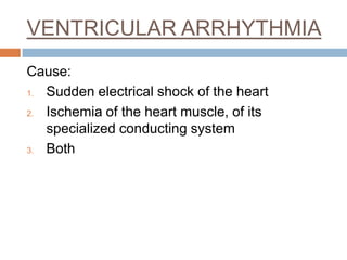 VENTRICULAR ARRHYTHMIA
Cause:
1. Sudden electrical shock of the heart
2. Ischemia of the heart muscle, of its
specialized conducting system
3. Both

 