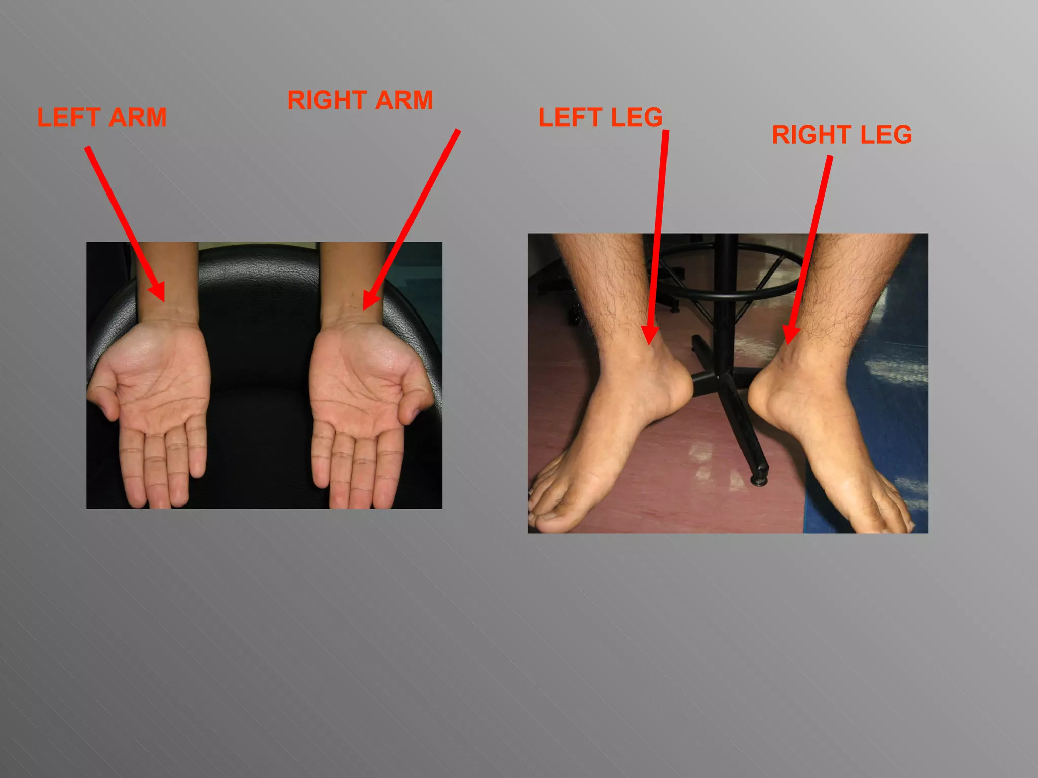 RIGHT ARM LEFT ARM RIGHT LEG LEFT LEG 