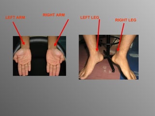 RIGHT ARM LEFT ARM RIGHT LEG LEFT LEG 