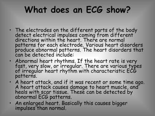 What does an ECG show? The electrodes on the different parts of the body detect electrical impulses coming from different directions within the heart. There are normal patterns for each electrode. Various heart disorders produce abnormal patterns. The heart disorders that can be detected include: Abnormal heart rhythms. If the heart rate is very fast, very slow, or irregular. There are various types of irregular heart rhythm with characteristic ECG patterns.  A heart attack, and if it was recent or some time ago. A heart attack causes damage to heart muscle, and heals with scar tissue. These can be detected by abnormal ECG patterns.  An enlarged heart. Basically this causes bigger impulses than normal. 
