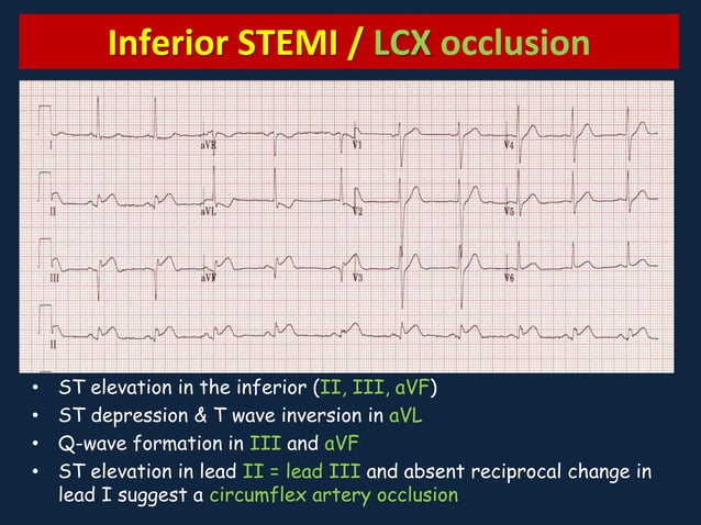 Myocardial Ischemia and Infarction | PPTX