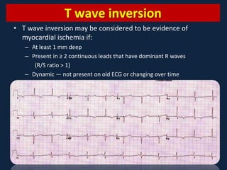 Myocardial Ischemia and Infarction | PPTX