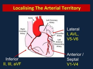 Myocardial Ischemia and Infarction | PPTX