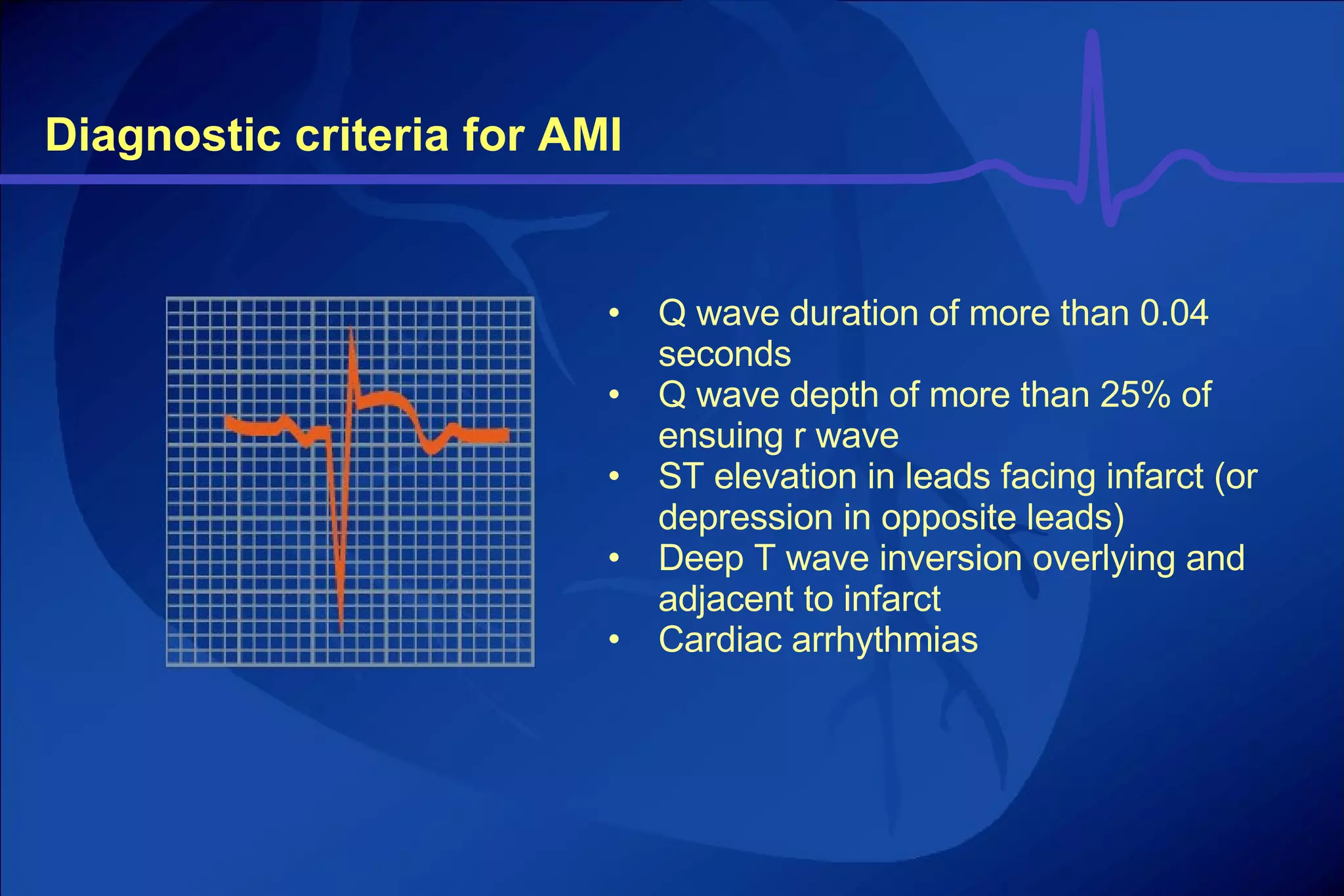 Ecg Part 1 | PPT