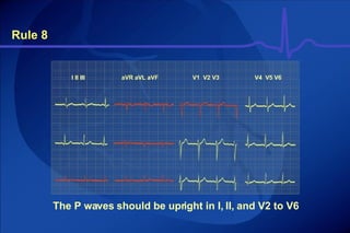Rule 8 The P waves should be upright in I, II, and V2 to V6 I II III aVR aVL aVF V1  V2 V3 V4  V5 V6 