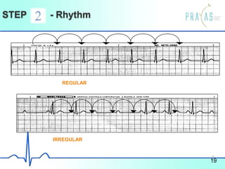 STEP - Rhythm
IRREGULAR
REGULAR
19
18
 