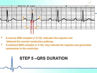 STEP 5 –QRS DURATION
• A narrow QRS complex (< 0.12), indicates the impulse has
followed the normal conduction pathway
• A widened QRS complex (> 0.12), may indicate the impulse was generated
somewhere in the ventricles
25
 