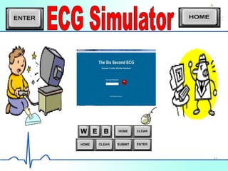 Ecg.exe
49
 