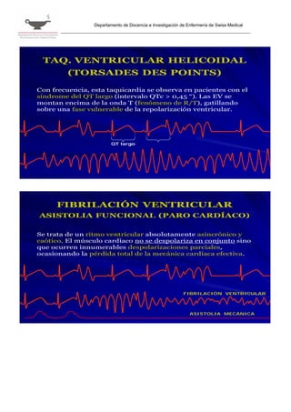 Departamento de Docencia e Investigación de Enfermería de Swiss Medical




 TAQ. VENTRICULAR HELICOIDAL
         (TORSADES DES POINTS)

Con frecuencia, esta taquicardia se observa en pacientes con el
sindrome del QT largo (intervalo QTc > 0,45 “). Las EV se
montan encima de la onda T (fenómeno de R/T), gatillando
sobre una fase vulnerable de la repolarización ventricular.




                         QT largo




     FIBRILACIÓN VENTRICULAR
ASISTOLIA FUNCIONAL (PARO CARDÍACO)

Se trata de un ritmo ventricular absolutamente asincrónico y
caótico. El músculo cardíaco no se despolariza en conjunto sino
que ocurren innumerables despolarizaciones parciales,
ocasionando la pérdida total de la mecánica cardíaca efectiva.




                                                           FIBRILACIÓN VENTRICULAR




                                                              ASISTOLIA MECÁNICA
 
