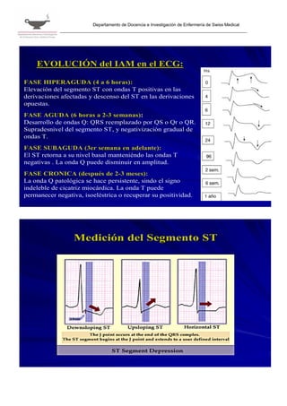Departamento de Docencia e Investigación de Enfermería de Swiss Medical




    EVOLUCIÓN del IAM en el ECG:
                                                                             Hs

FASE HIPERAGUDA (4 a 6 horas):
Elevación del segmento ST con ondas T positivas en las
derivaciones afectadas y descenso del ST en las derivaciones
opuestas.
FASE AGUDA (6 horas a 2-3 semanas):
Desarrollo de ondas Q: QRS reemplazado por QS o Qr o QR.
Supradesnivel del segmento ST, y negativización gradual de
ondas T.
FASE SUBAGUDA (3er semana en adelante):
El ST retorna a su nivel basal manteniéndo las ondas T
negativas . La onda Q puede disminuir en amplitud.
FASE CRONICA (después de 2-3 meses):
La onda Q patológica se hace persistente, sindo el signo
indeleble de cicatriz miocárdica. La onda T puede
permanecer negativa, isoeléstrica o recuperar su positividad.




                  Medición del Segmento ST
 