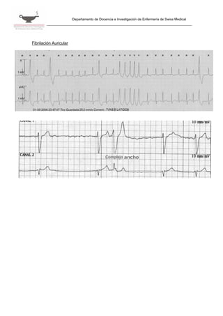 Departamento de Docencia e Investigación de Enfermería de Swiss Medical




Fibrilación Auricular
 